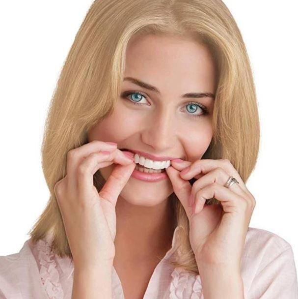 DentureSnap™ – Sofortige Snap-On-Veneers