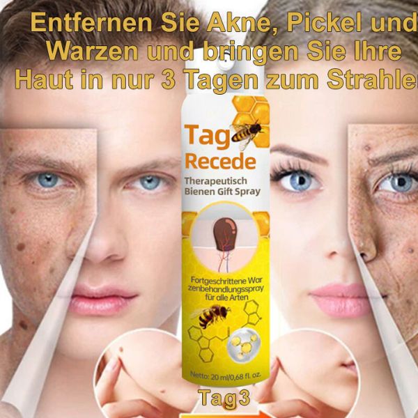1+1 Gratis | DermiClear™ - Bienengift-Spray zur Entfernung von Warzen und Muttermalen