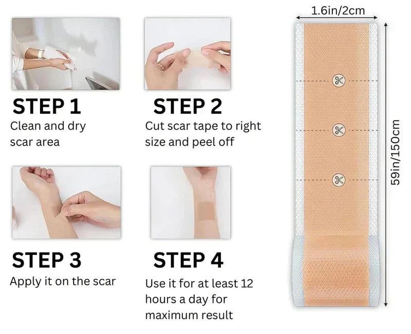 1+1 Gratis | GlowScar™ – Silikon-Narbenentfernungsfolien