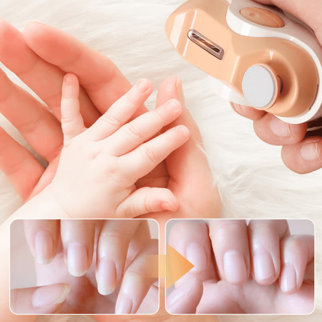 GeniusNailPro™ – 2-in-1-Elektronagelknipser und -polierer