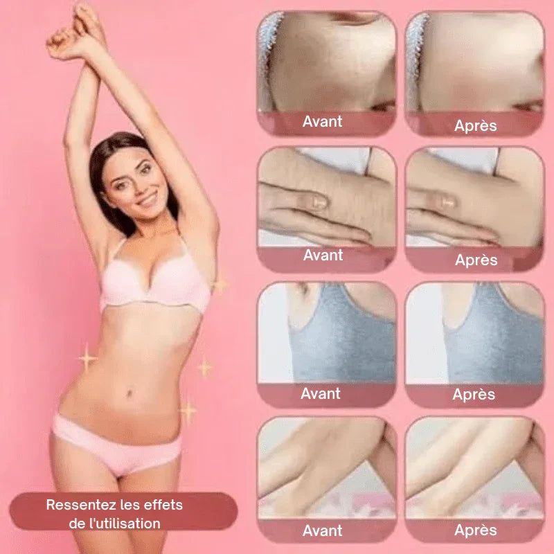 NuitLisse™ Épilation sans douleur pour une peau parfaitement lisse - Rondor
