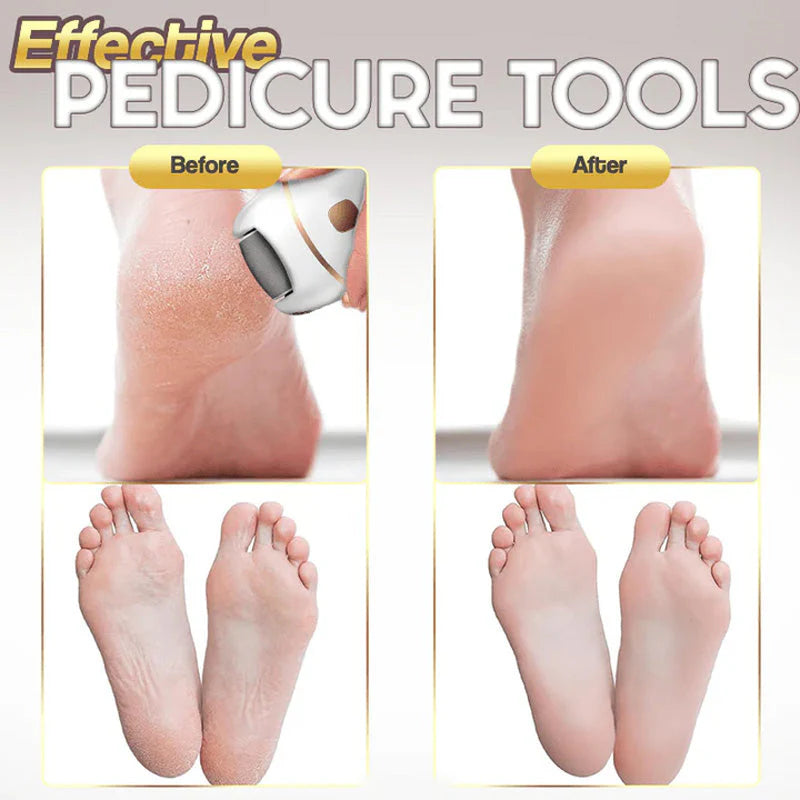 CleanHeel™ – Sanfte Hornhautentfernung für weiche, glatte Füße