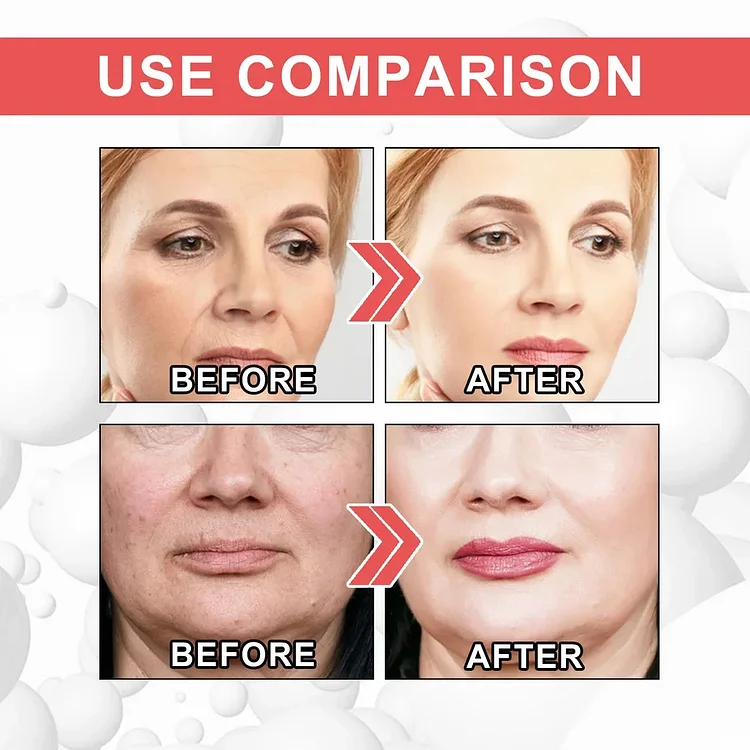 1+1 Gratis | Collagen Serum - Reparieren und befeuchten die Haut!