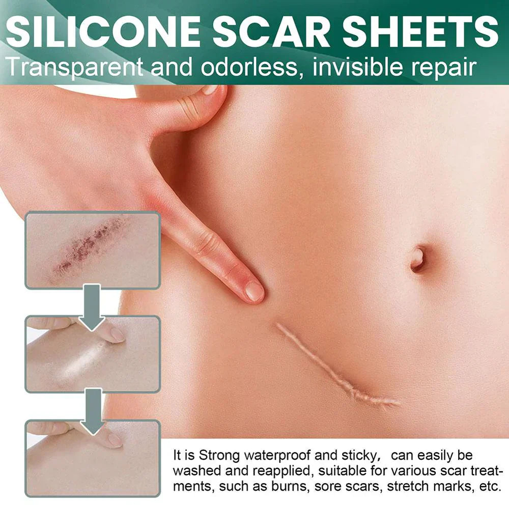1+1 Gratis | GlowScar™ – Silikon-Narbenentfernungsfolien