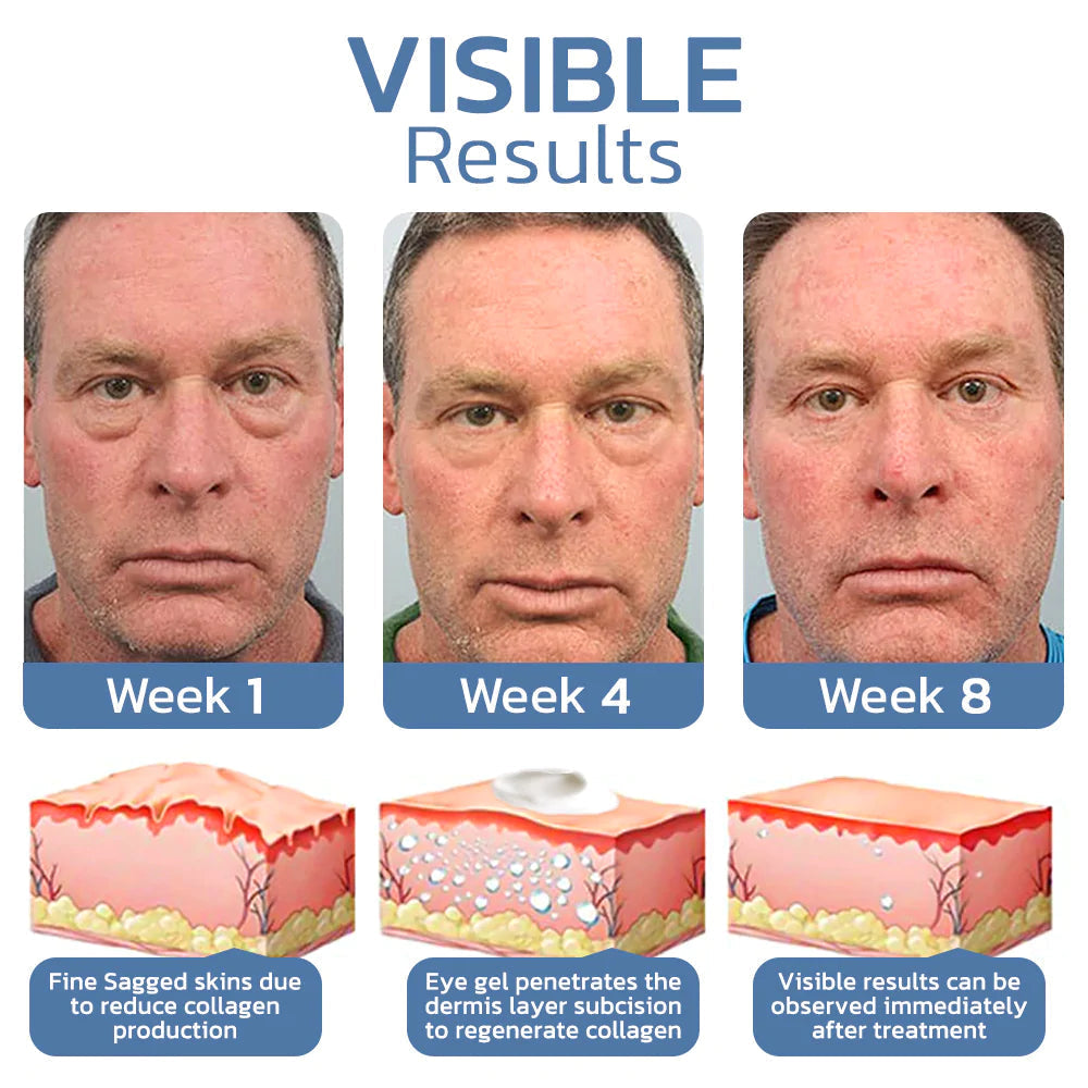 1+1 Gratis | OpenEyes - Verjüngendes Augen-Lifting-Gel für Männer und Frauen