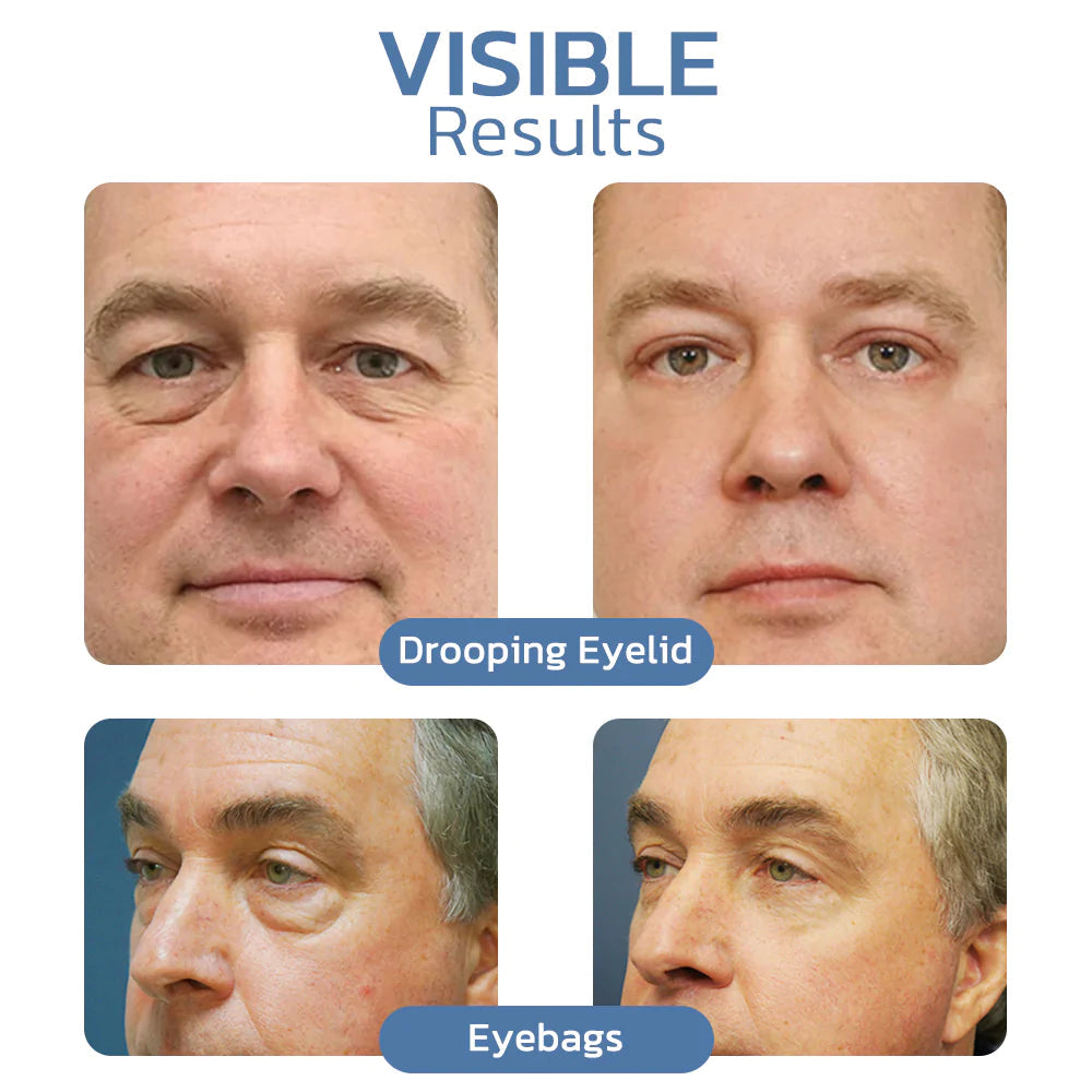 1+1 Gratis | OpenEyes - Verjüngendes Augen-Lifting-Gel für Männer und Frauen